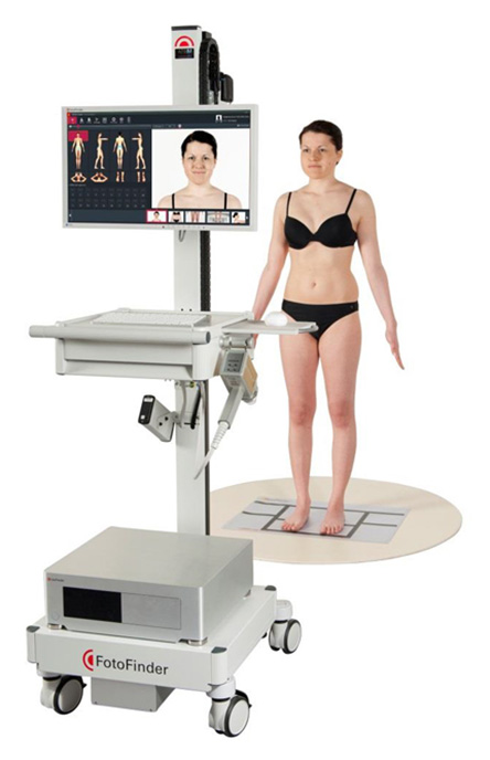 Σπίλοι (Ελιές): Νέα Ψηφιακή μέθοδος για την Ολόσωμη Χαρτογράφηση & την Πρόληψη του Δερματικού Καρκίνου-2