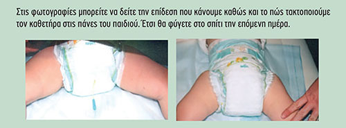 Yποσπαδίας: Απαντήσεις σε όλα όσα ρωτούν οι γονείς-1