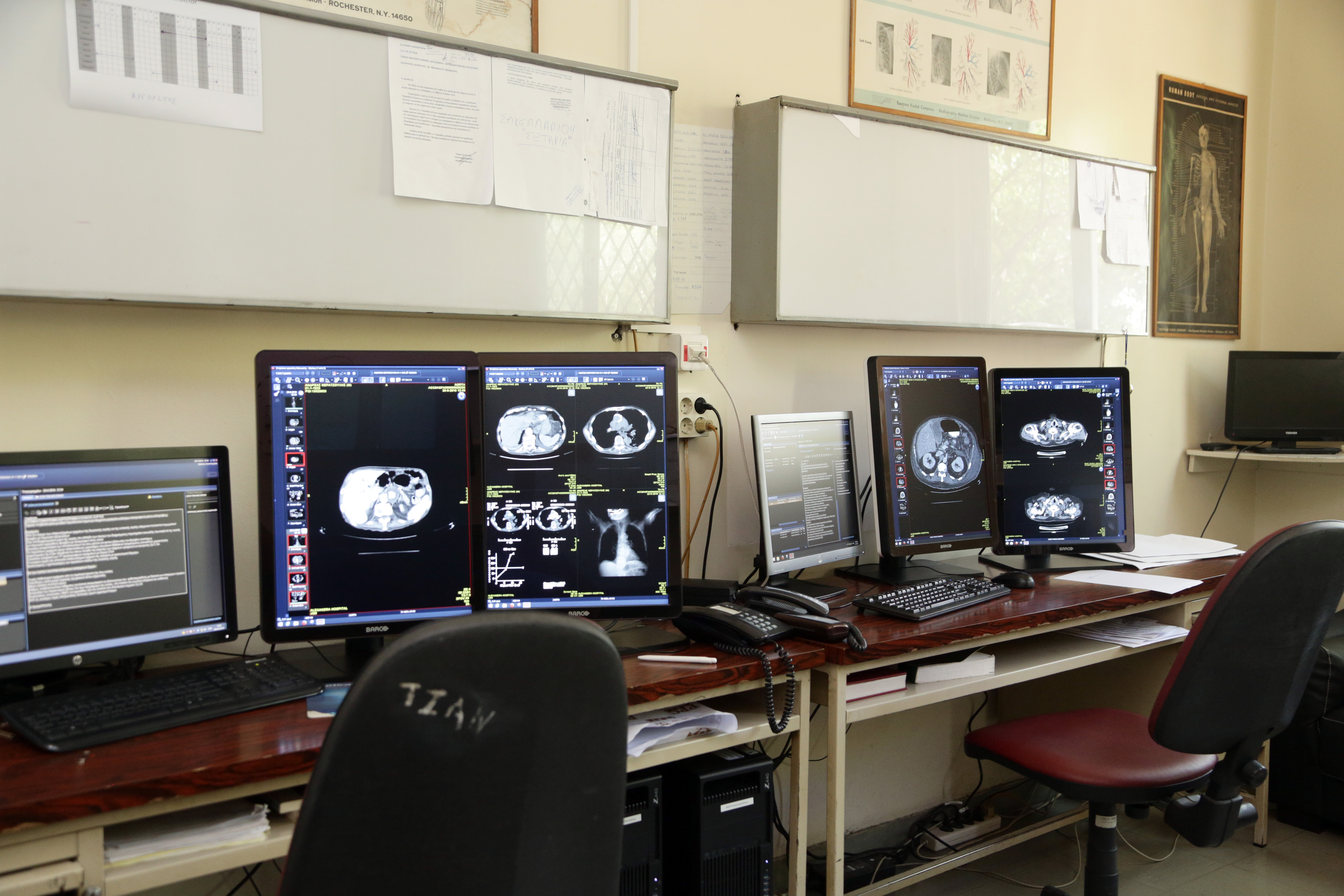 Στην αιχμή της τεχνολογίας το Τμήμα απεικόνισης μαστού του Γ.Ν.Α. «Αλεξάνδρα»-1