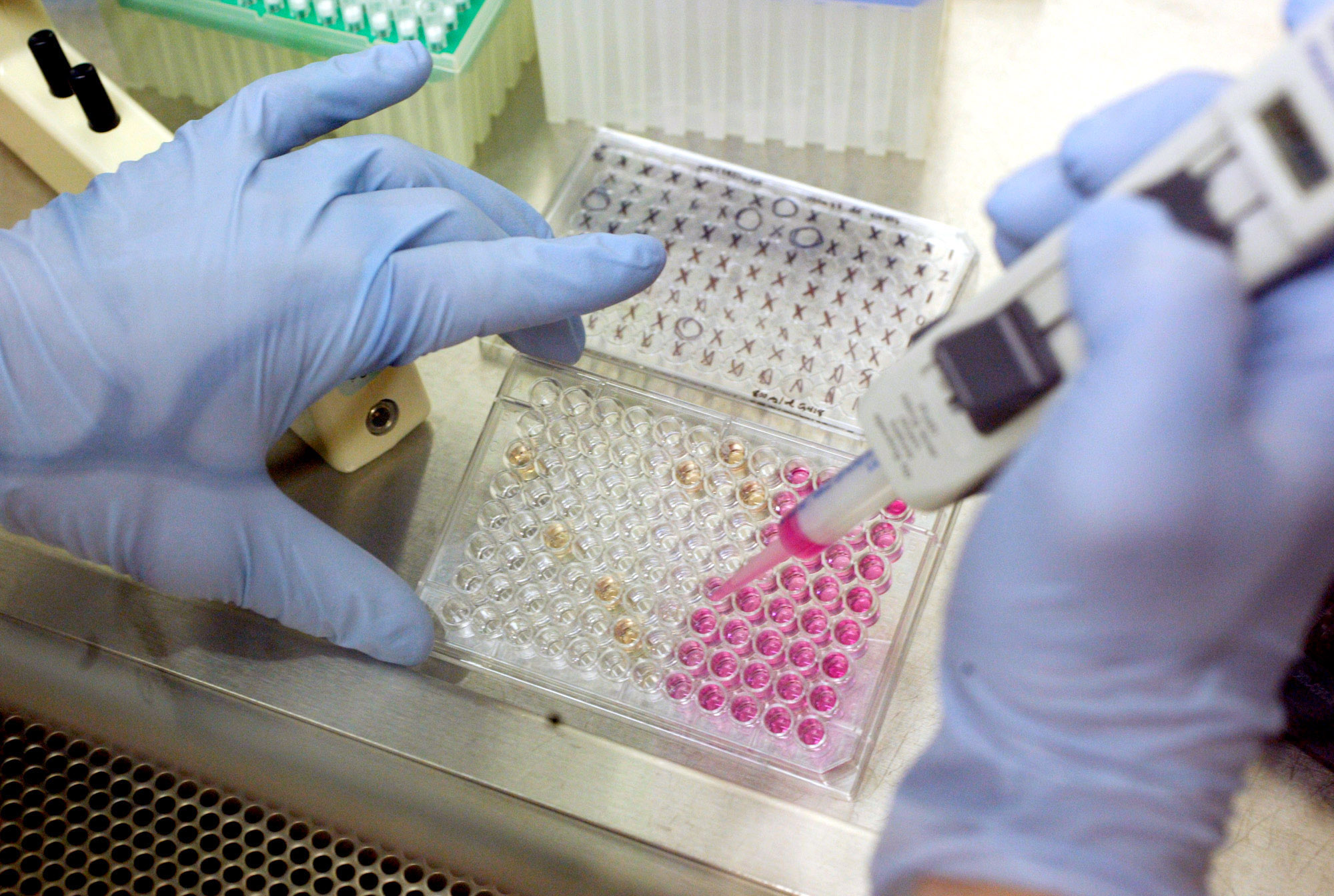 Ιός Δυτικού Νείλου: Η μετάδοσή του, τα συμπτώματα και τι πρέπει να προσέχουμε-5