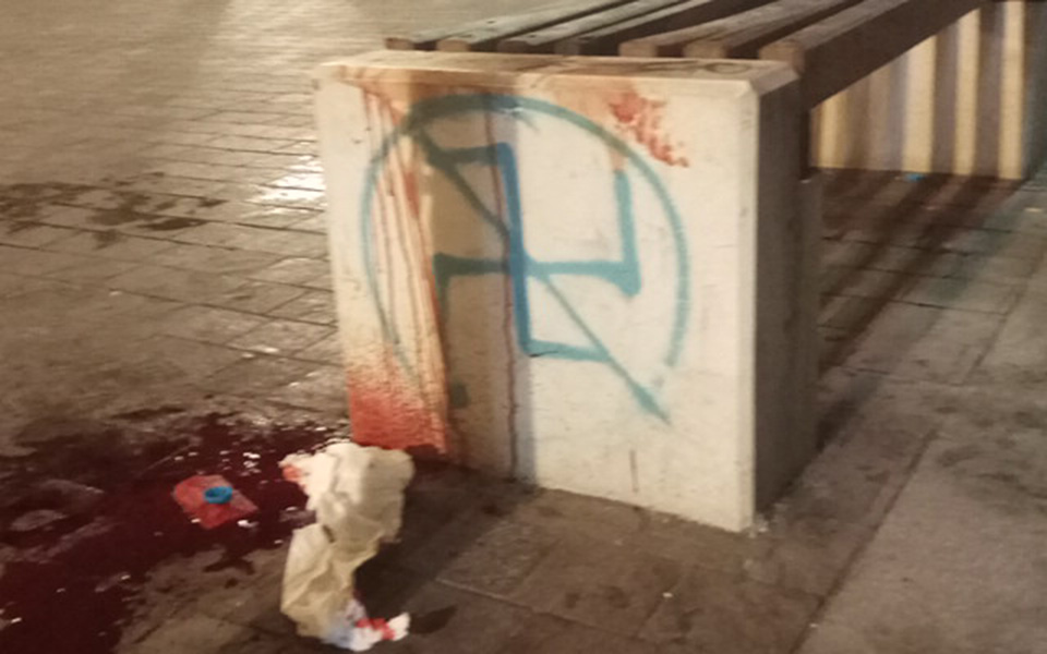 Συλλήψεις και προσαγωγές στο Αγρίνιο – Με σοβαρά τραύματα στο πρόσωπο νοσηλεύεται η 19χρονη (φωτογραφίες – βίντεο)-4
