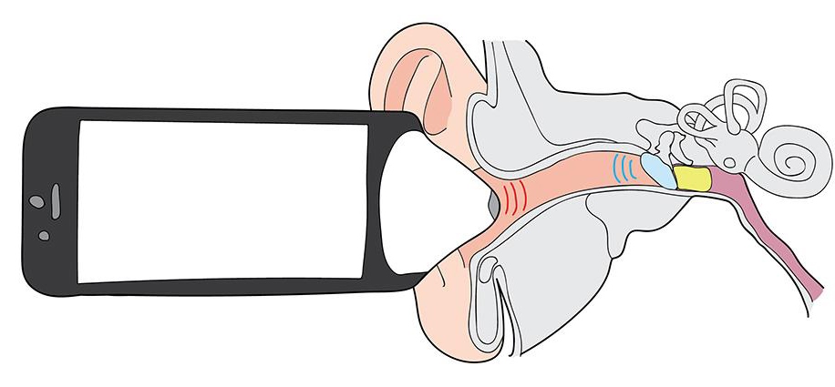 Eφαρμογή κινητού «ακούει» τις ωτίτιδες χωρίς καν διάγνωση από γιατρό-1