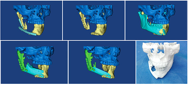 Η ζωή είναι 3D. Τώρα, είναι και η χειρουργική μόνο στο Metropolitan-1