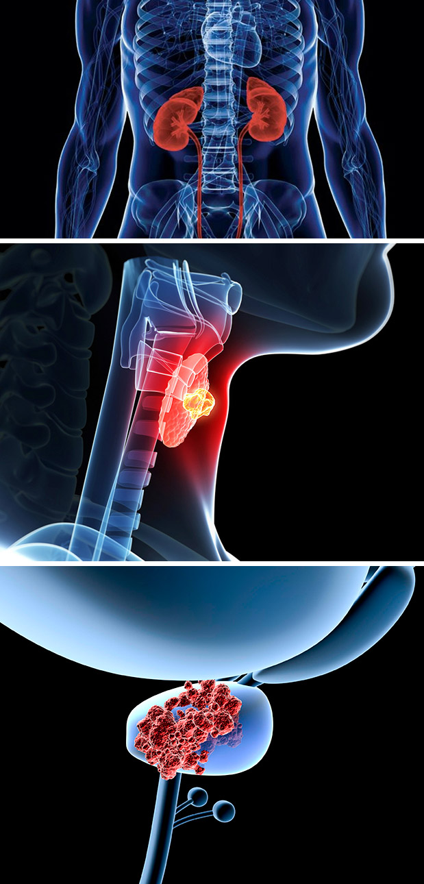 Μetropolitan: Fusion Virtual Navigation για βιοψίες χωρίς άσκοπες επεμβάσεις-1