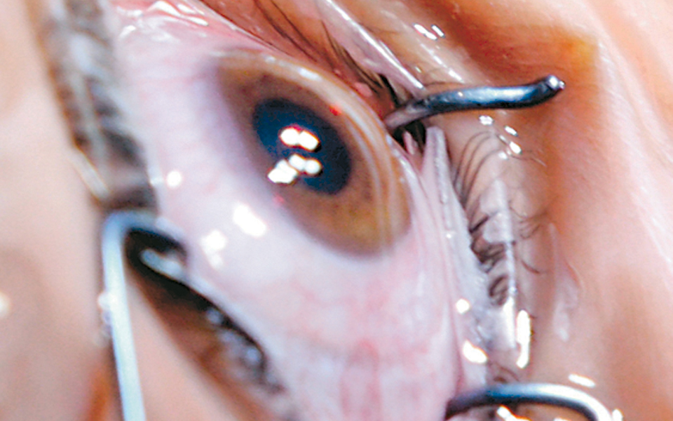 γενετική-θεραπεία-αποκατέστησε-την-ό-2001560