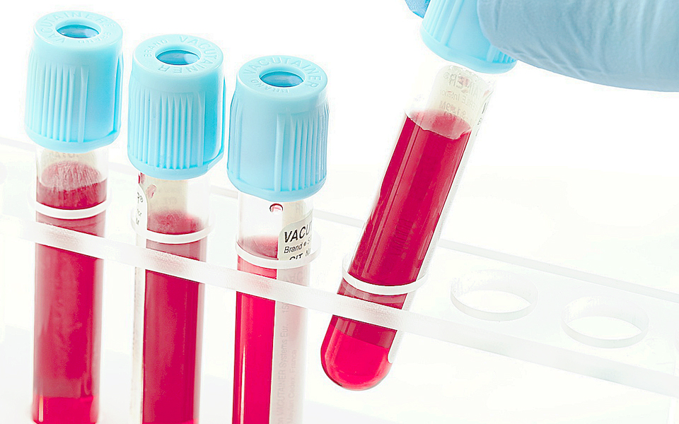 διάγνωση-καρκίνου-με-μία-απλή-εξέταση-2003128