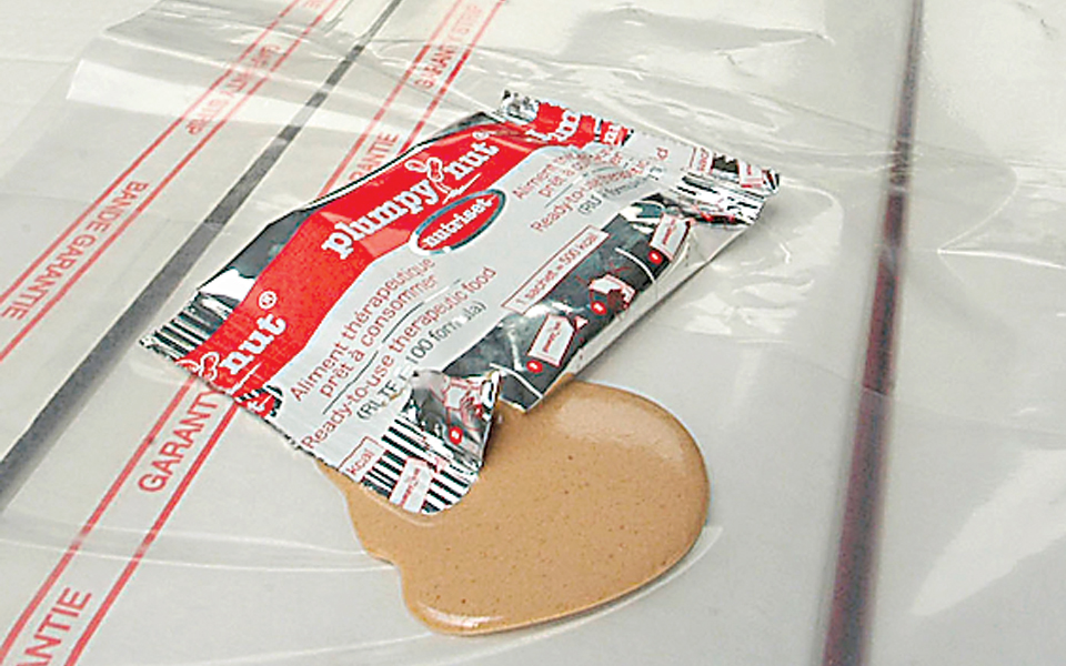 τέλος-στην-αλλεργία-από-τα-φιστίκια-2004225