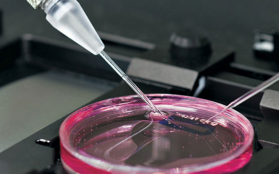 ακόμα-και-η-καλή-χοληστερόλη-μπορεί-2003334