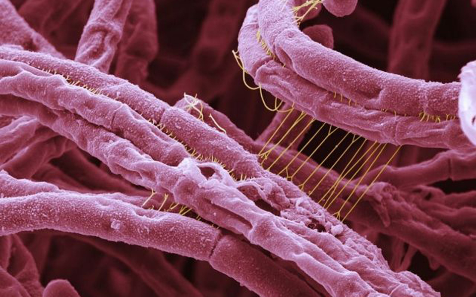 δεν-αποκλείεται-η-επιστροφή-της-θανατ-2003636