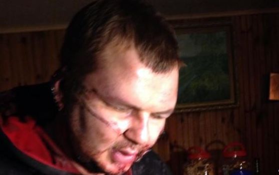 ουκρανία-απαγωγή-και-βασανισμός-διαδ-2004268