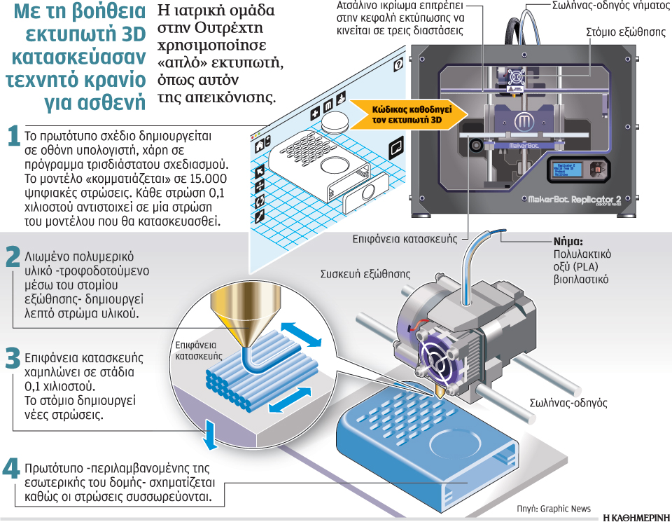 ιατροί-τοποθέτησαν-τεχνητό-κρανίο-σε-2014447