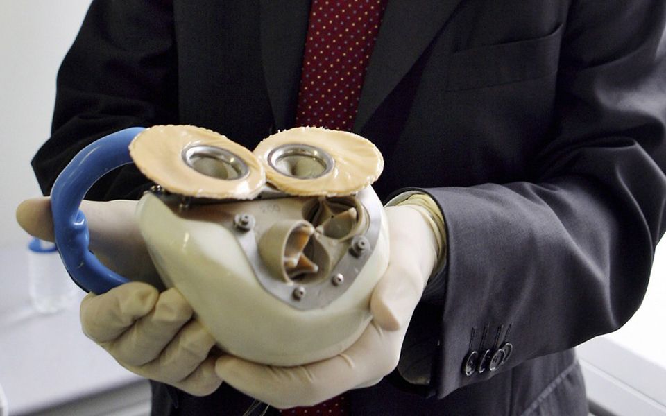 πέθανε-ο-πρώτος-ασθενής-με-τεχνητή-καρ-2010004