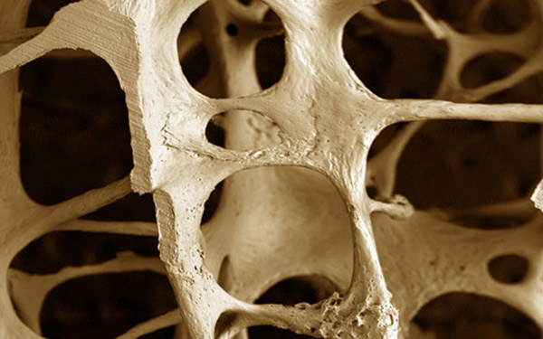 ασπίδα-στην-οστεοπόρωση-η-πρόληψη-2010545