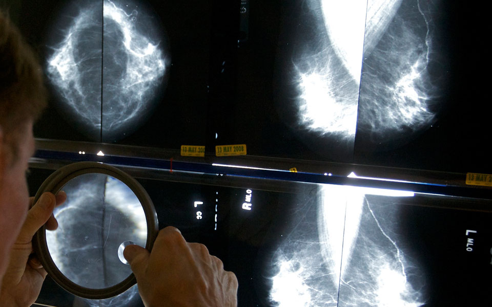 διαφορετικά-τα-υπέρ-και-τα-κατά-τη-2015192