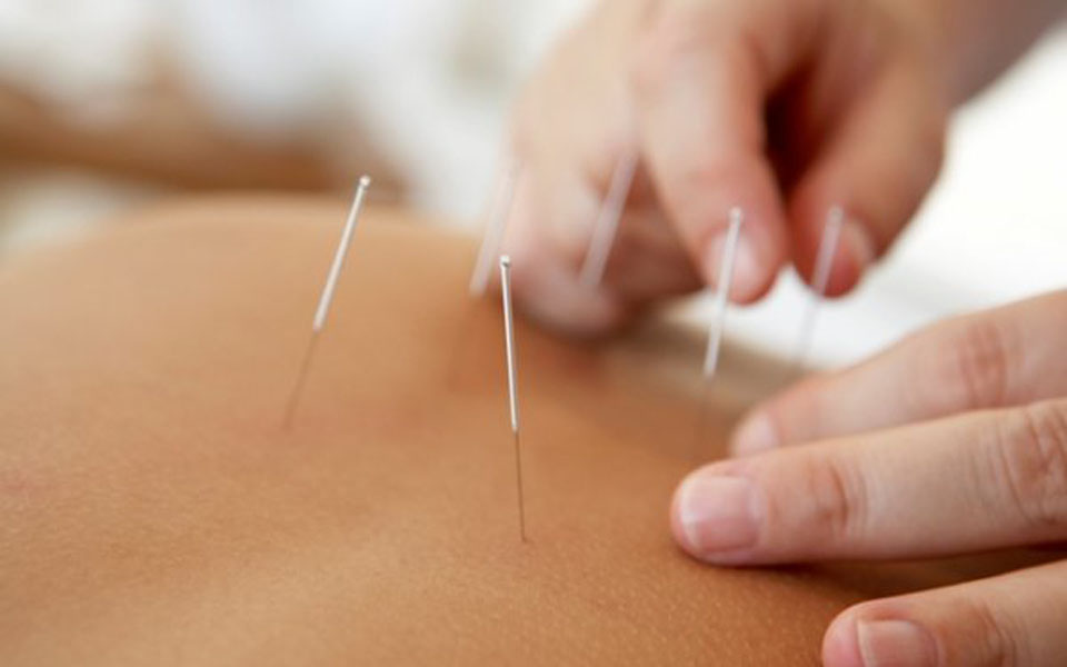 ο-βελονισμός-στην-ιατρική-σήμερα-2019332