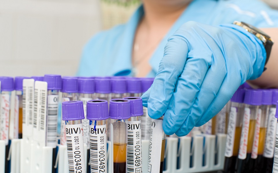 διαφορετικοί-καρκίνοι-προτιμούν-φ-2025869