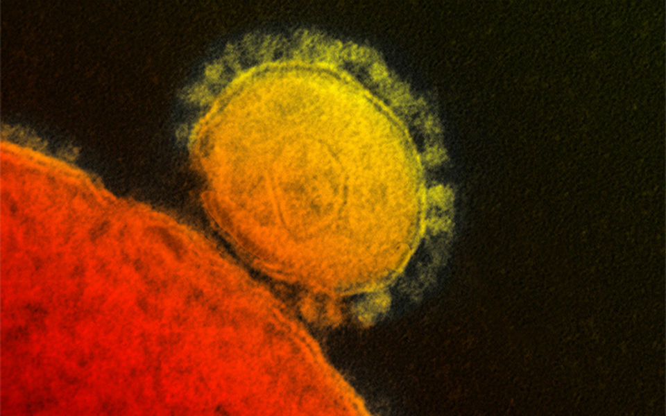 θετικός-στον-mers-κάτοικος-του-ιλινόις-2024038