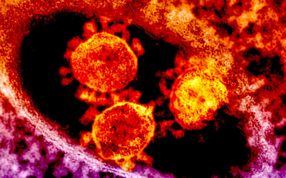 ιράν-σε-δύο-αδερφές-τα-πρώτα-επιβεβαιω-2026141