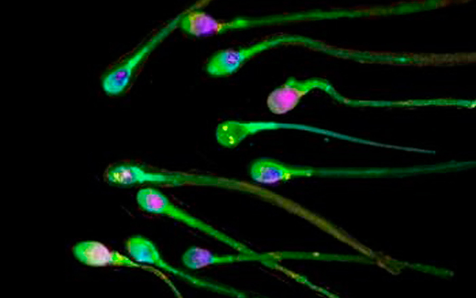 ασφαλέστερη-τεχνητή-γονιμοποίηση-2036190