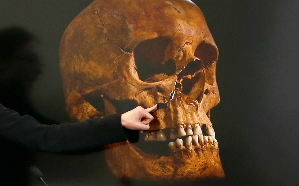 βρήκαν-την-αιτία-θανάτου-του-ριχάρδου-2044980