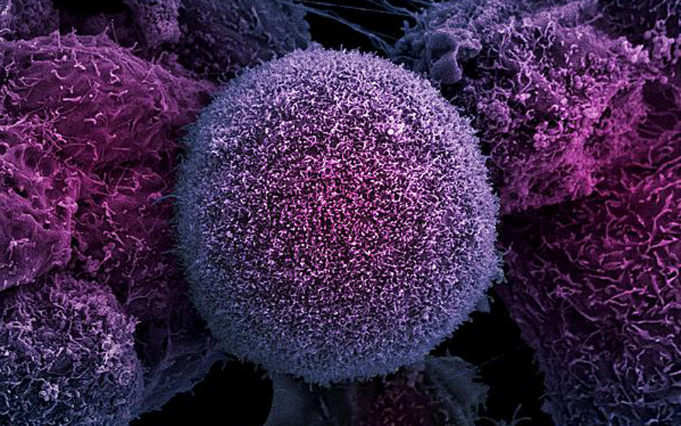 πειραματικό-φάρμακο-καταστρέφει-του-2050993