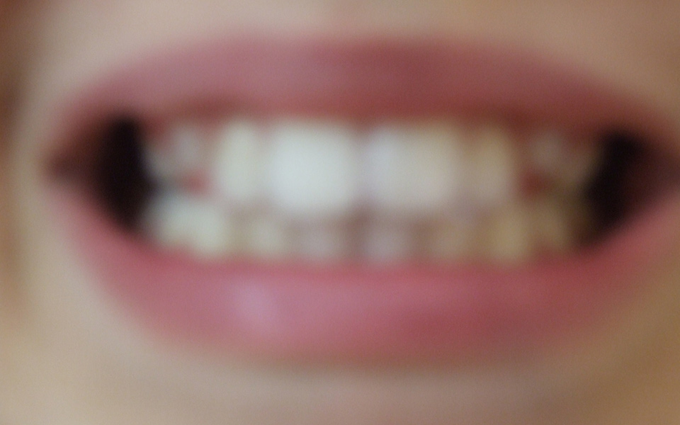 ανησυχητικά-τα-στοιχεία-για-παιδιά-με-2050815