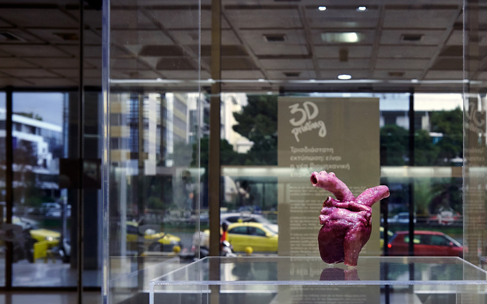 στο-ωνάσειο-η-πρώτη-ανθρώπινη-καρδιά-α-2070477