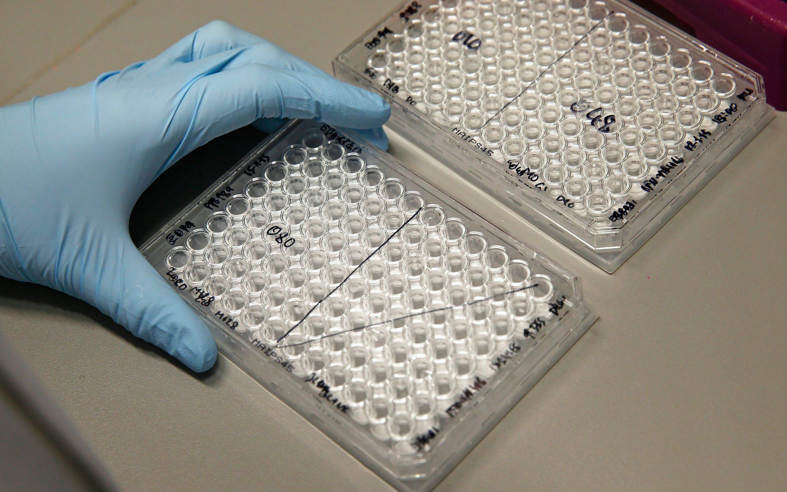 πειραματικά-εμβόλια-κατά-του-εμπολα-σ-2075056