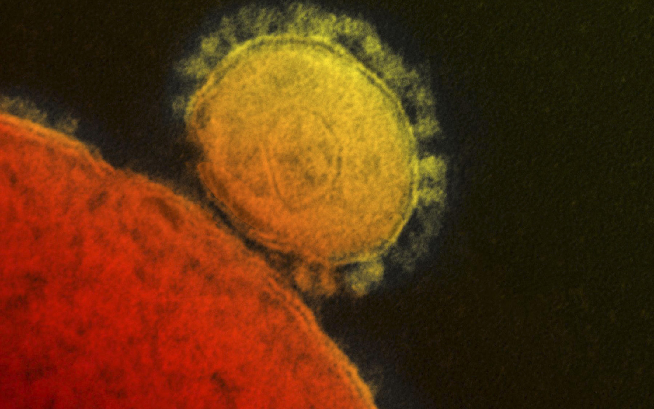 ανεβαίνει-ο-αριθμός-των-κρουσμάτων-κο-2085444