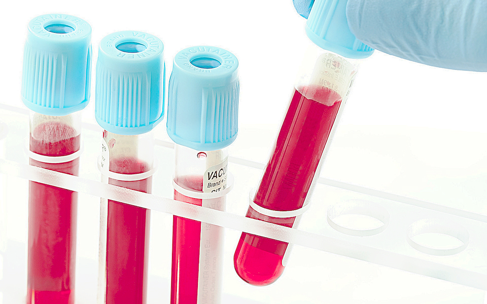 για-πρώτη-φορά-θα-δοκιμασθεί-σε-ανθρώπ-2093992