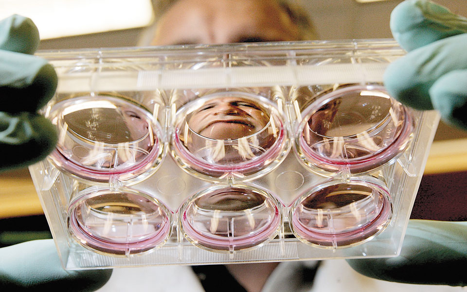 πιο-κοντά-στη-διάγνωση-του-καρκίνου-πα-2096131