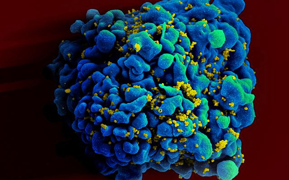 που-οι-ασθενείς-του-hiv-πρέπει-να-λαμβάνο-2103793