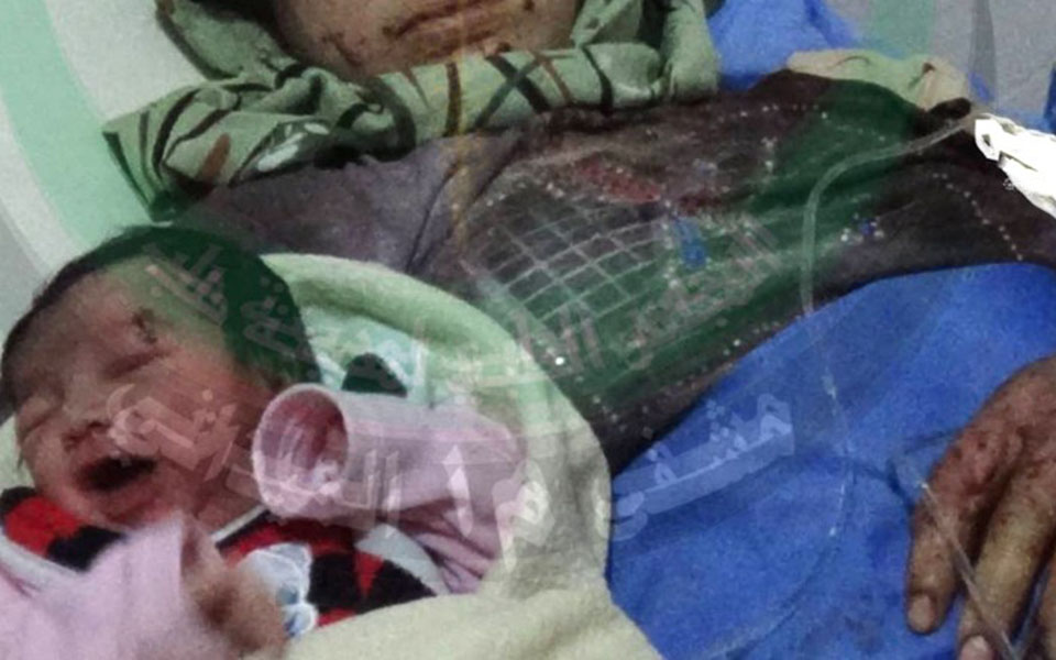 συρία-μωρό-γεννήθηκε-με-θραύσμα-οβίδα-2102808