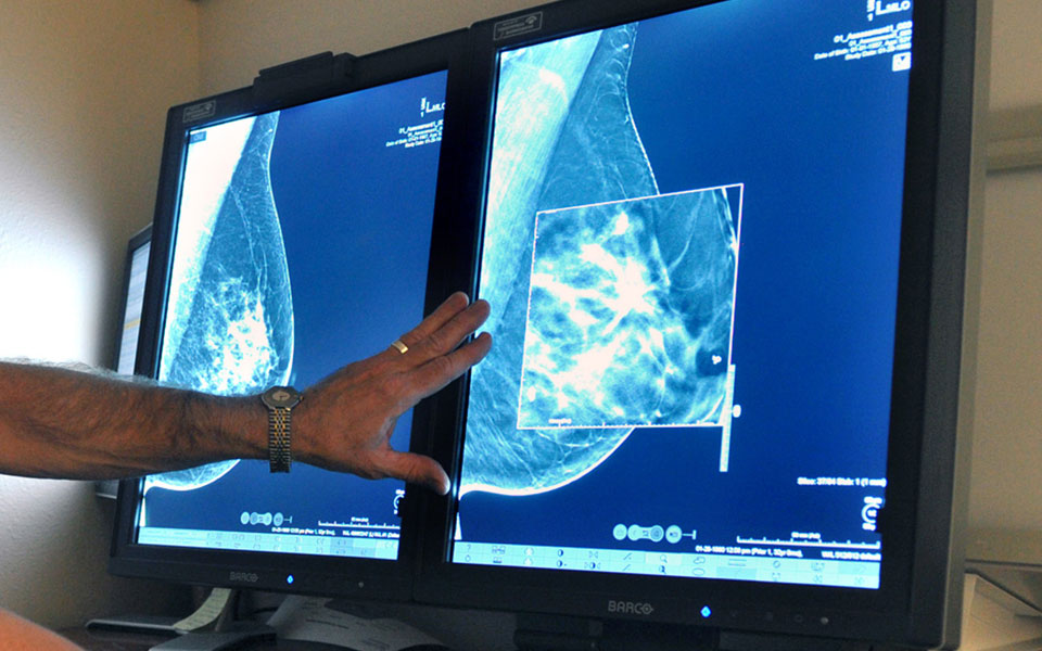 μαστογραφία-στα-45-έως-τα-54-έτη-μετά-ανά-δ-2107166