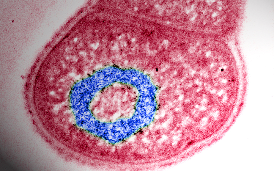 μόλυνση-από-υπερβακτήριο-2135829