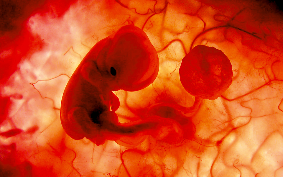 h-καισαρική-επηρέασε-την-εξέλιξή-μας-2164553