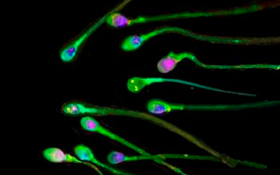 eλεγχος-σπερματοζωαρίων-με-έξυπνη-εφα-2181703