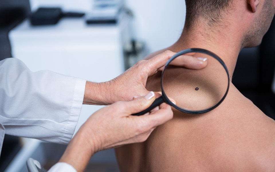 πώς-γίνεται-ο-έλεγχος-των-σπίλων-η-διάγ-2195257