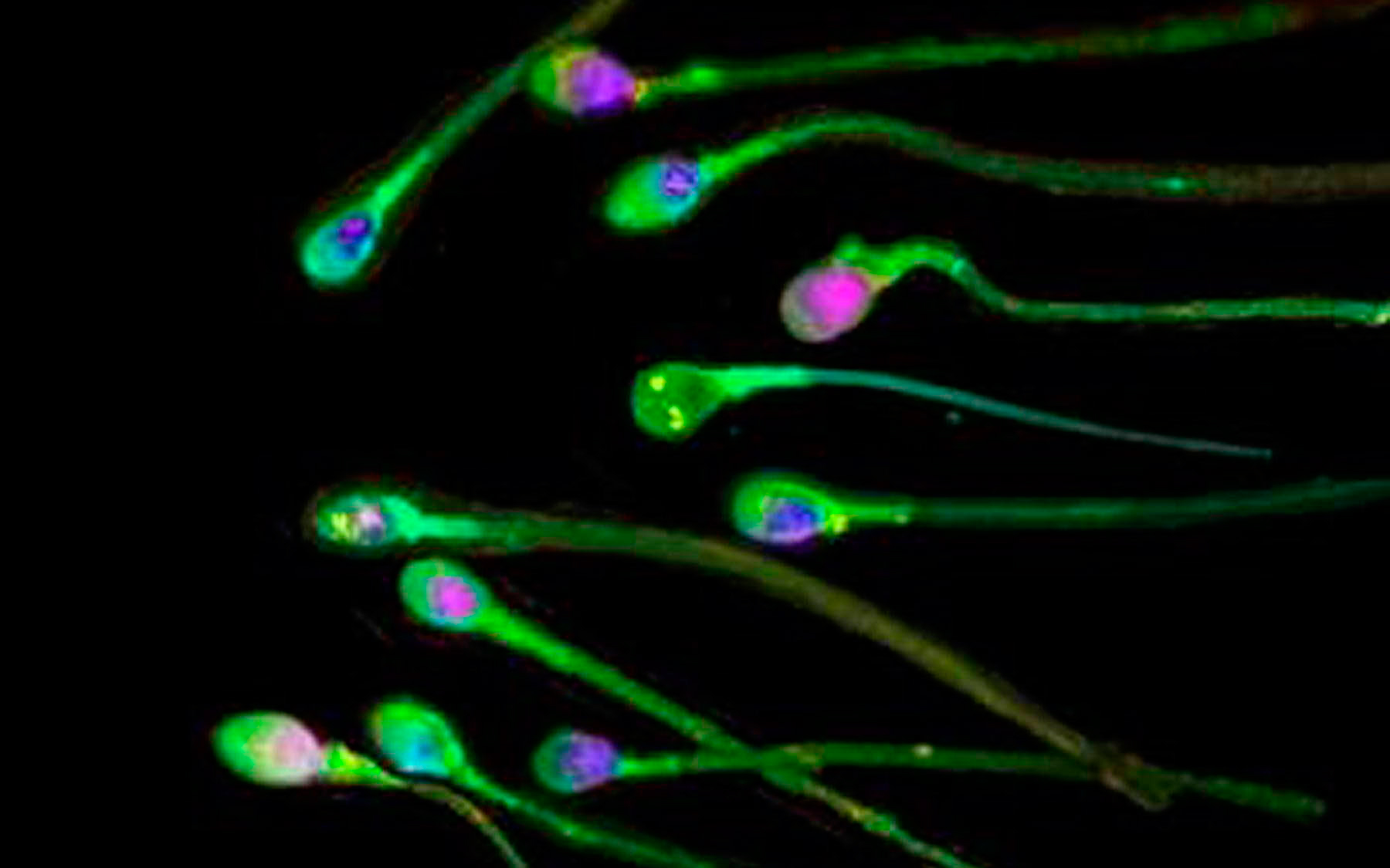 οι-συνθήκες-διαβίωσης-στον-ανεπτυγμέ-2201953
