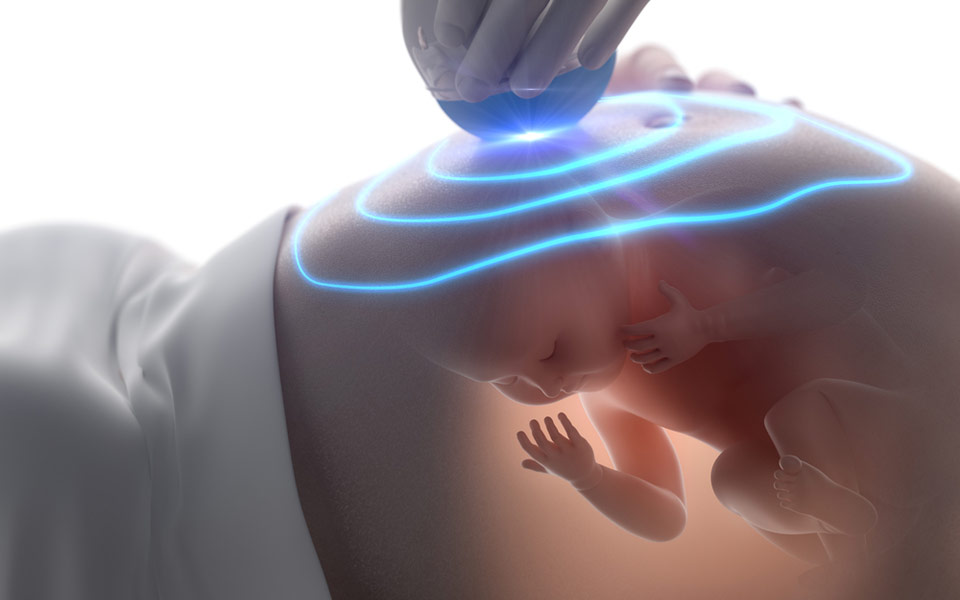 ο-ρόλος-της-3d-και-4d-υπερηχογραφίας-στη-μα-2203036