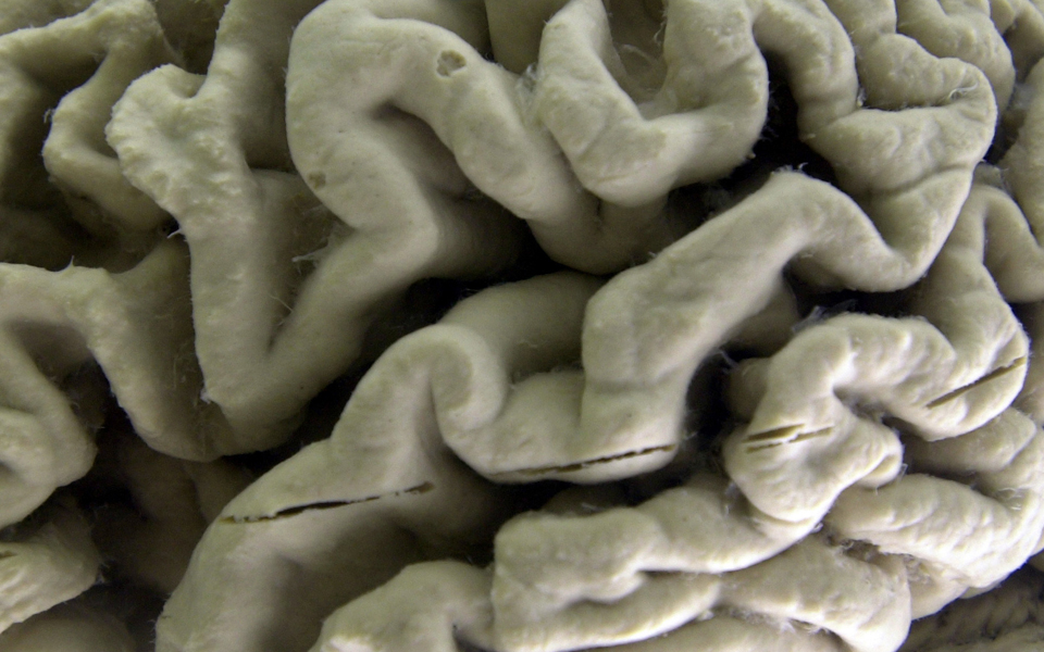 ηλεκτρονικό-παιχνίδι-κατά-της-άνοιας-2206785