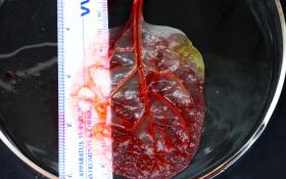 ενα-φύλλο-σπανακιού-μετατρέπεται-σε-α-2203325