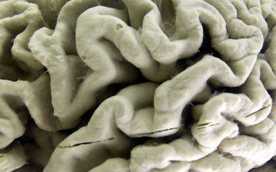 παγκόσμια-φιλόδοξη-έρευνα-για-τον-τρό-2210020