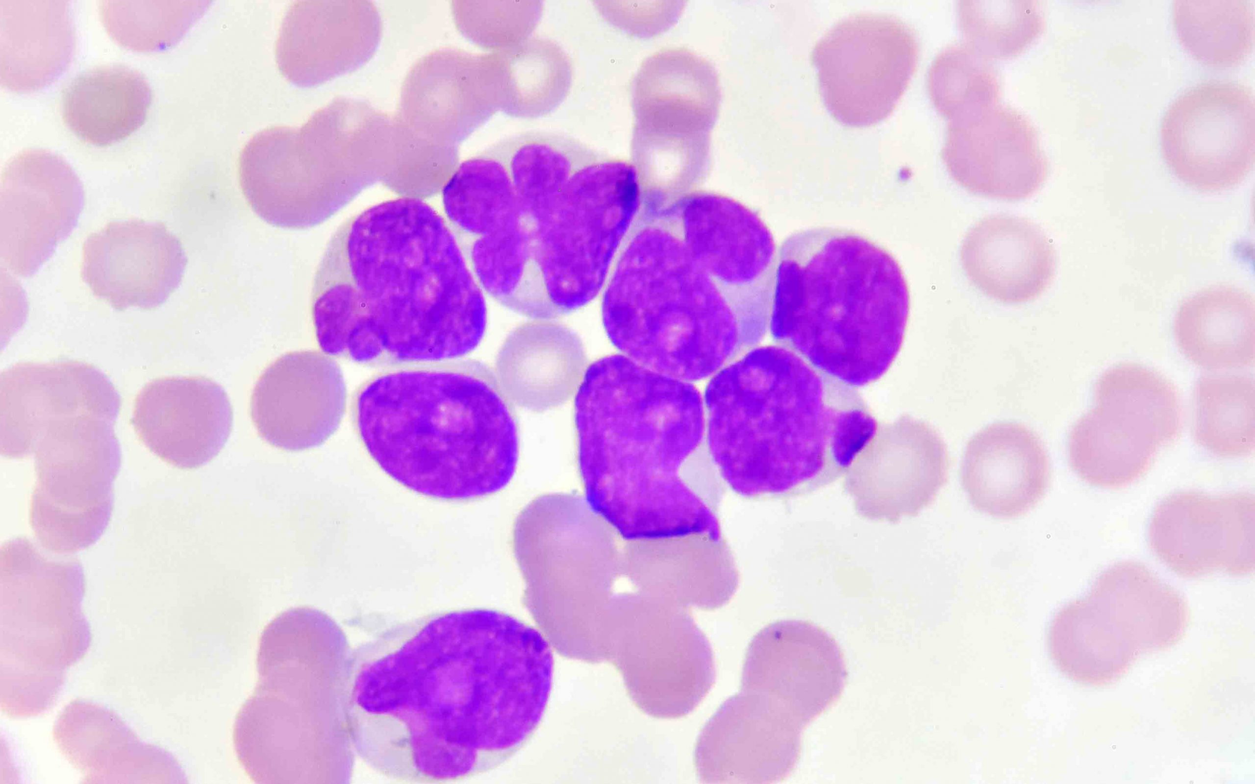 ελπίδες-για-νέο-φάρμακο-κατά-της-οξεία-2220221