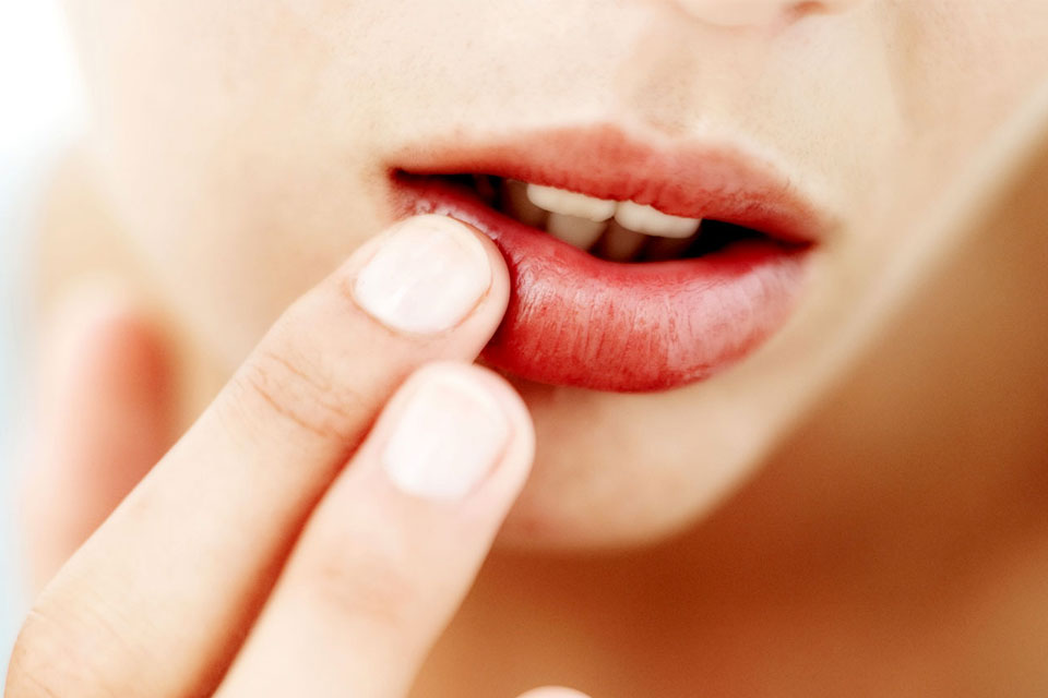 tα-must-πρϊόντα-για-σκασμένα-χείλη-2219521