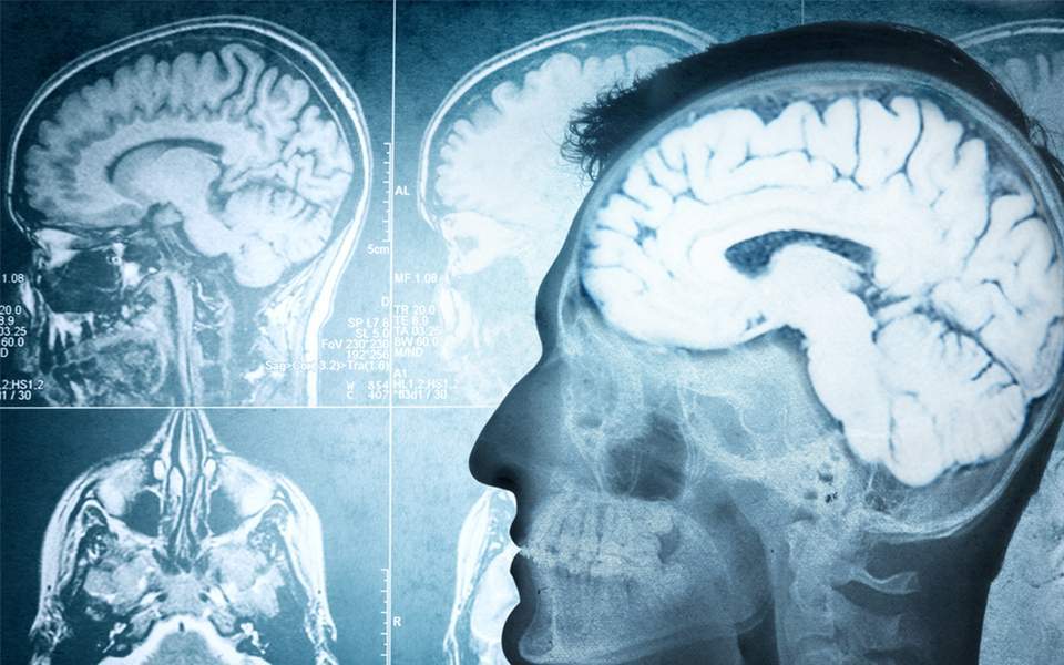 τεστ-αίματος-σε-πειραματικό-στάδιο-αν-2230812