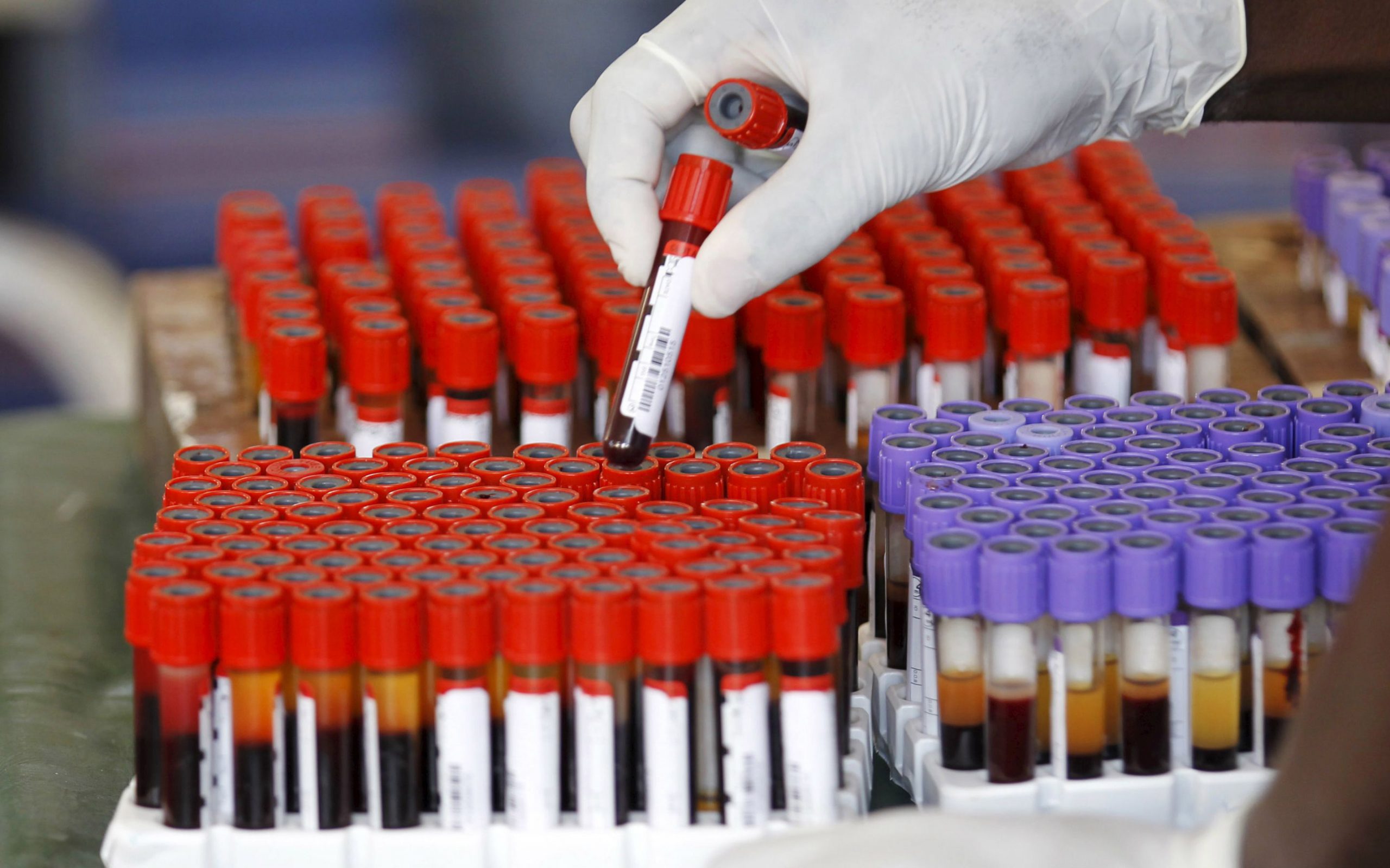 νέα-γονιδιακή-θεραπεία-για-τη-μεσογει-2245450