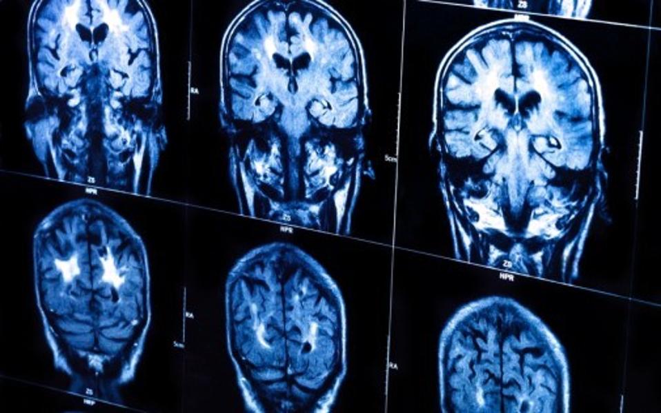 ερευνα-αυξημένος-ο-κίνδυνος-θανάτου-α-2243637