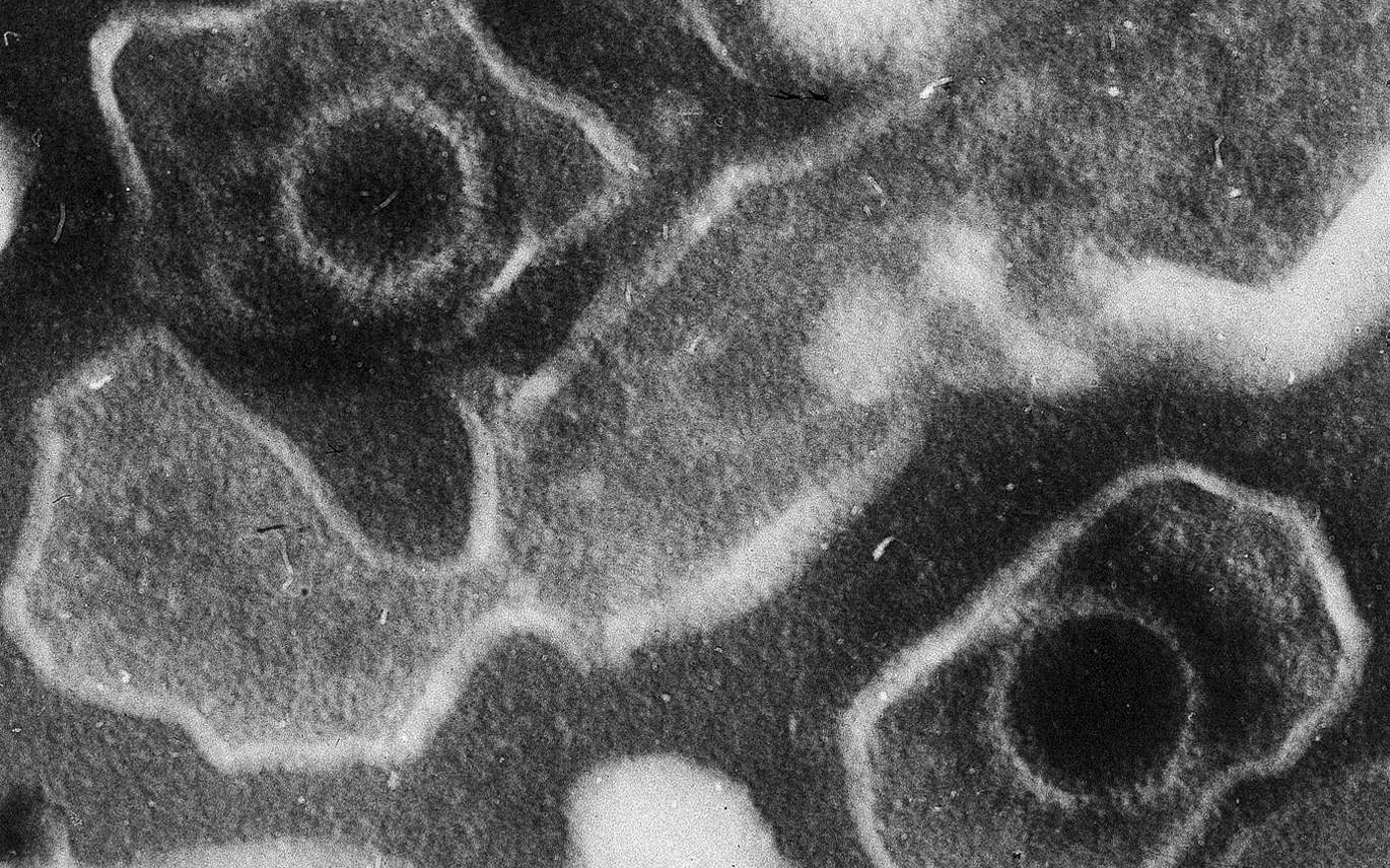 o-ιός-της-ασθένειας-του-φιλιού-υπεύθυ-2244991