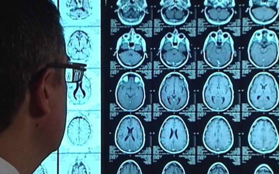 για-πρώτη-φορά-πειράματα-με-μίνι-εγκεφ-2250269